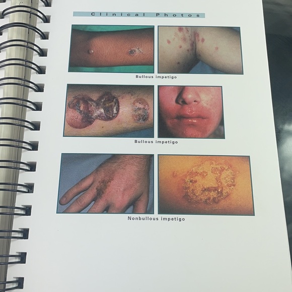 Diagnostic Algorithms in Dermatology: Disease and Treatment Pathways - Picture 7 of 8